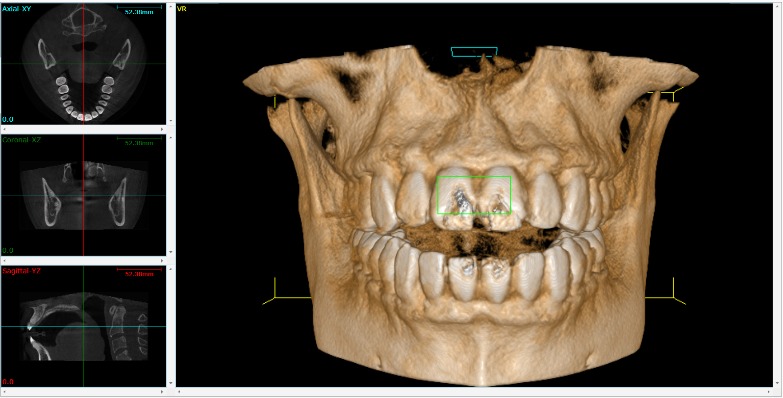 Cone Beam 3D Imaging  Belleville, IL 